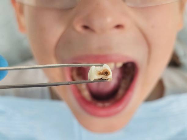 Best Walk-In Emergency Dentist in Bronx, NY